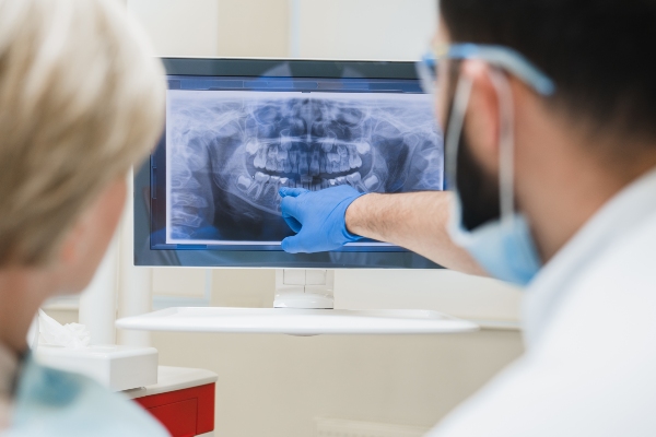 The Benefits Of Early Gum Disease Treatment
